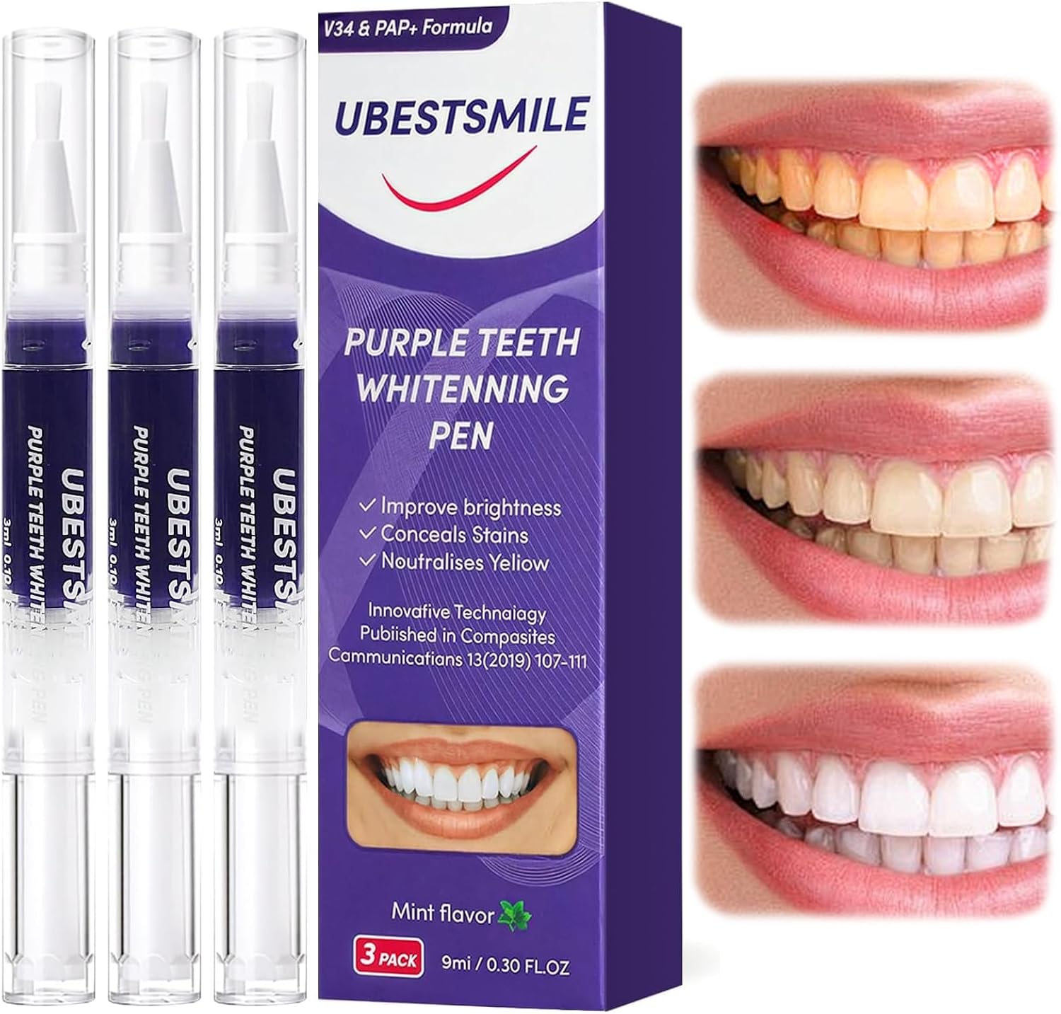 UBESTSMILE V34&PAP+ Formula Pu - Teeth Whitening Pens review and price