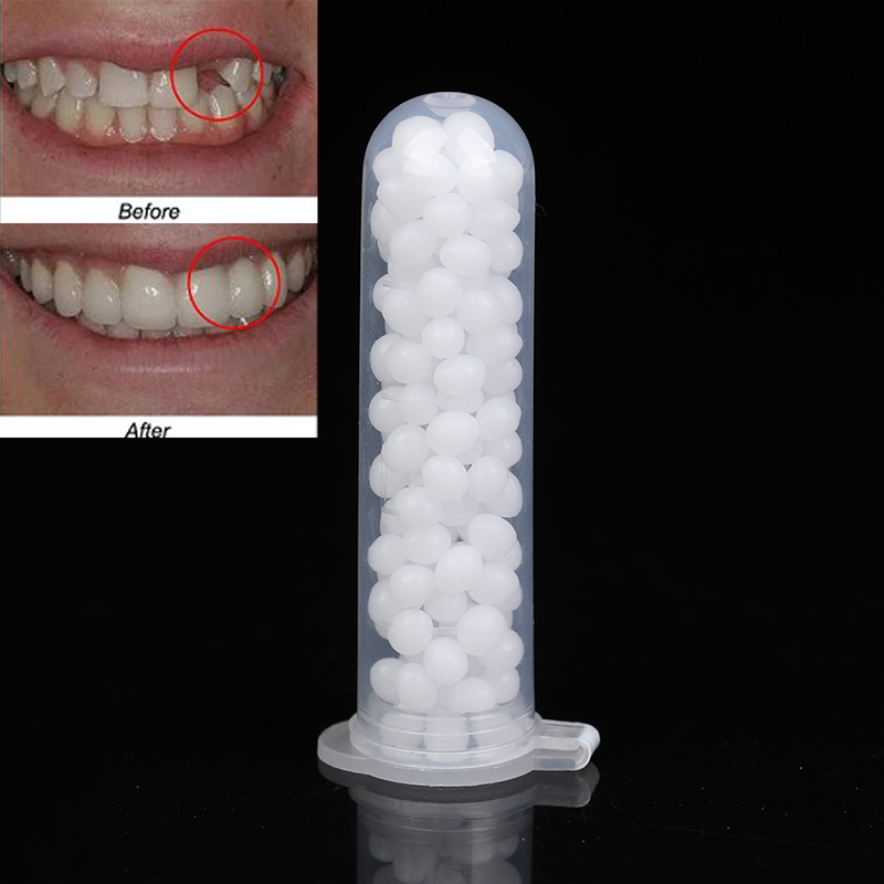 【K】1Box Temporary Tooth Repair - Teeth Whitening Kit review and price